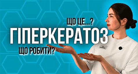 Жорстка шкіра? ГІПЕРКЕРАТОЗ: лікування і поради косметолога.